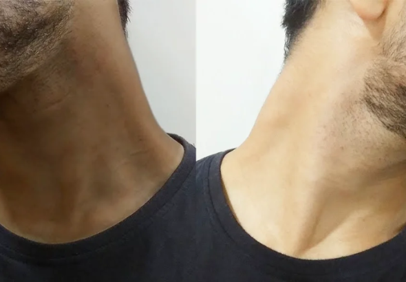 how to get rid of dark neck